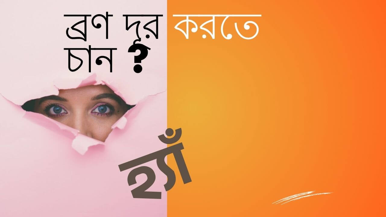 Image-ব্রন হওয়ার কারন কি?